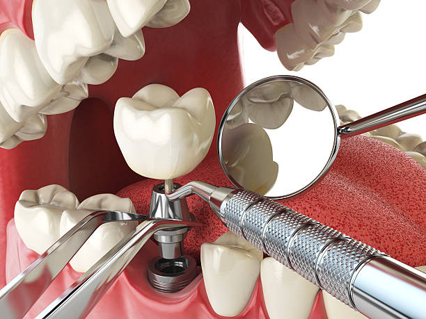Best Broken Tooth Emergency  in Natalbany, LA