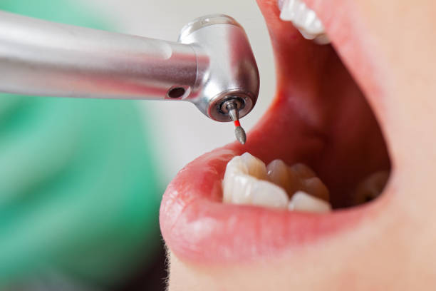 Dentist for Dental Trauma in LA